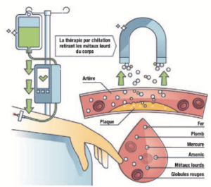 processus_chelation_vasculaire_ozondenia